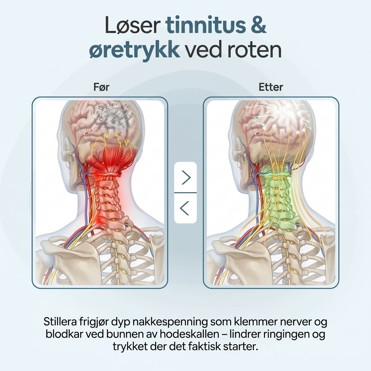 Sliter du med øresus som aldri gir seg?