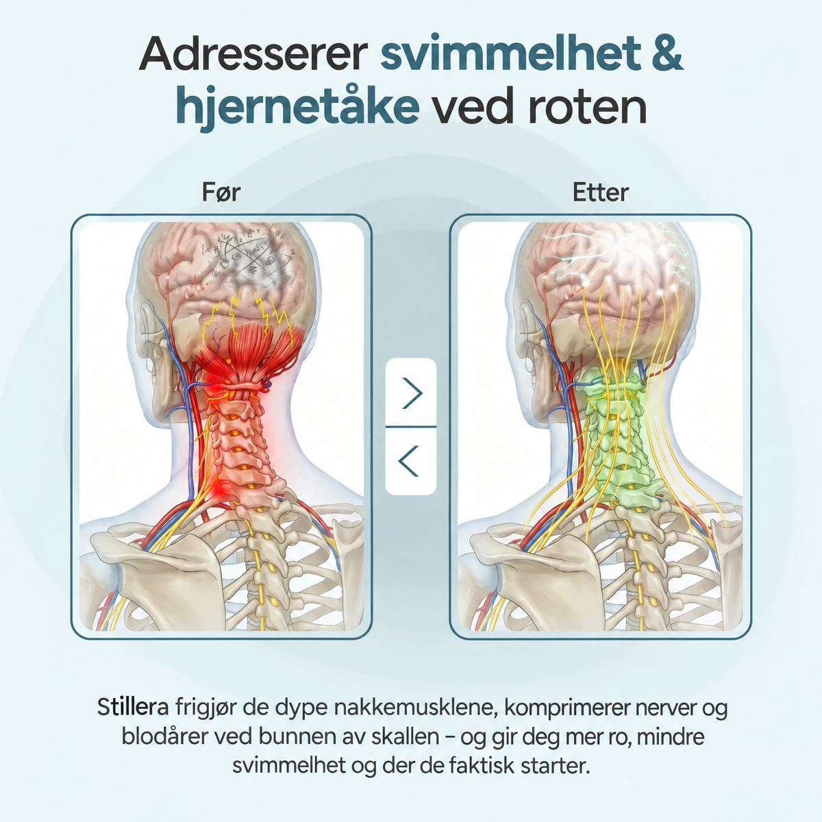 Sliter du med konstant svimmelhet eller den følelsen av å gå på en båt?