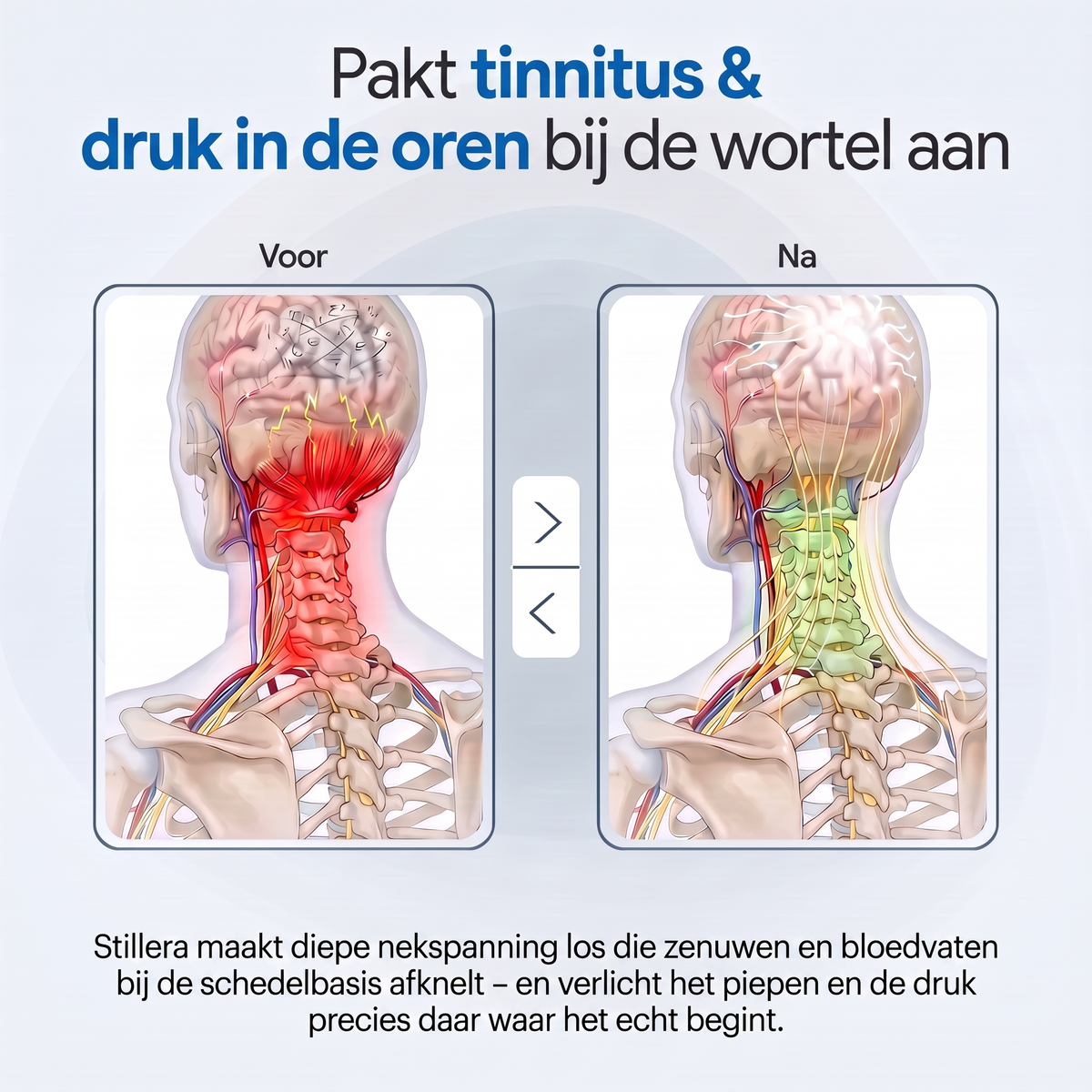 Heb je last van oorsuizen dat maar niet weggaat?